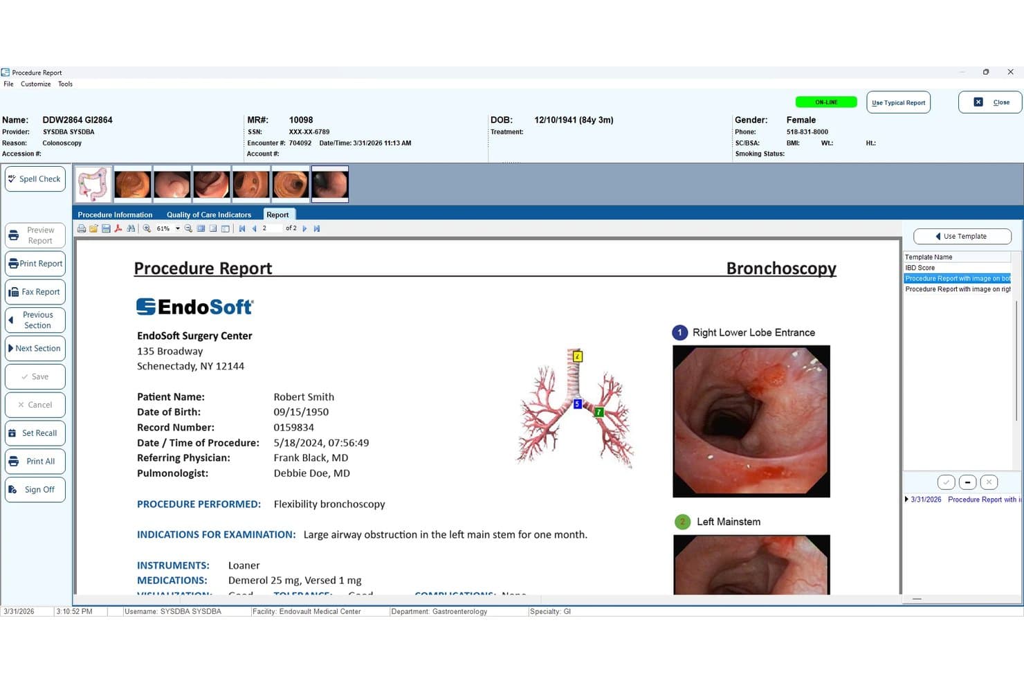 EndoSoft procedure report showing bronchoscopy findings with lung images and patient details.