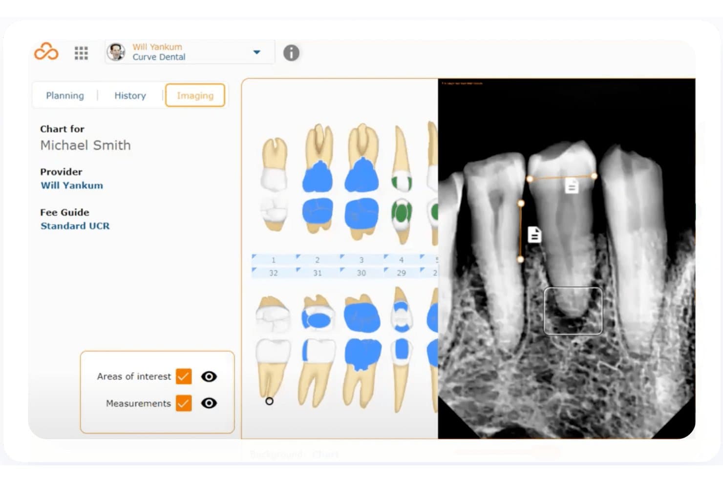 Curve Dental UI showing tooth chart, dental X-ray with measurements, and imaging tools.