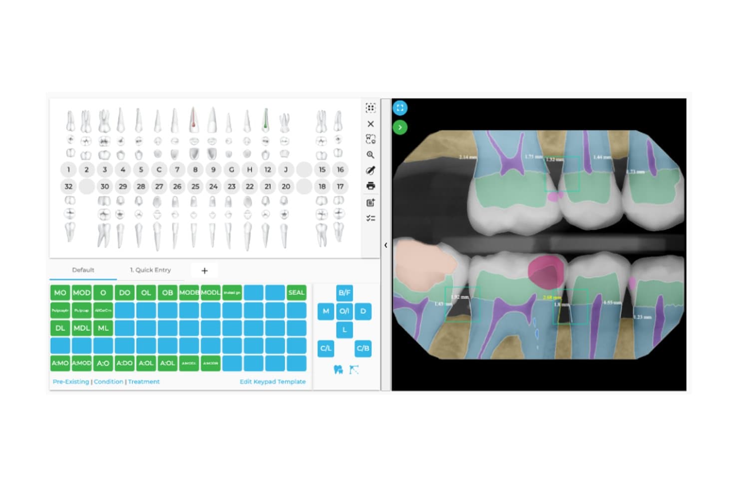 tab32 dental EMR clinical charting screen showing a tooth chart and treatment plan.