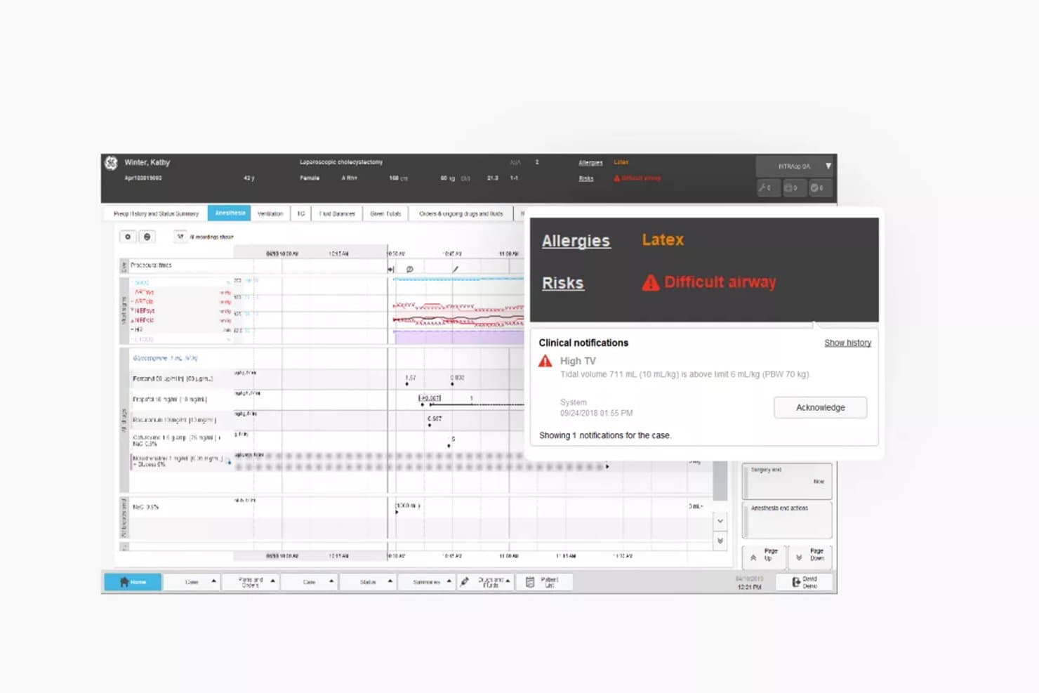 GE Healthcare-anestesi-EMR som visar en panel med allergier, riskvarningar och kliniska meddelanden.