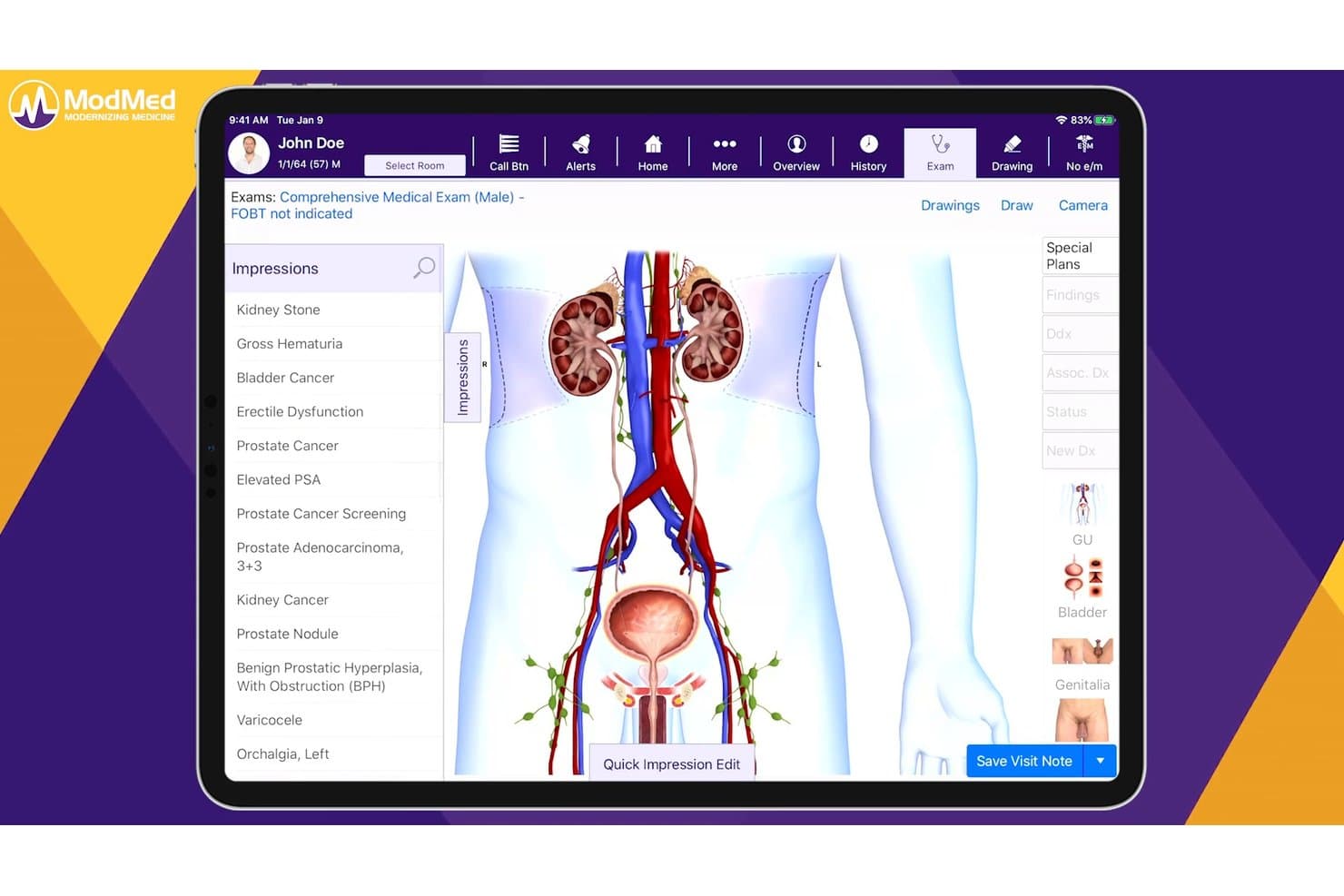ModMed urology EMR showing anatomy diagram and impressions list on tablet.
