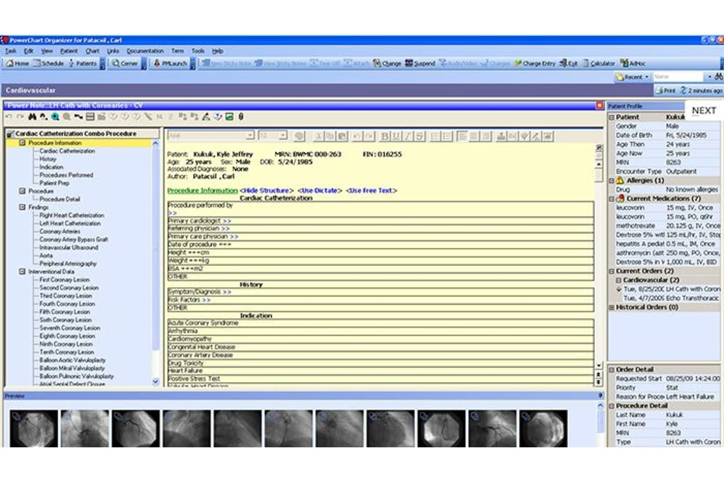 Cerner PowerChart-kardiologi-EMR, der viser notater om hjertekateteriseringsprocedurer og patientprofil.