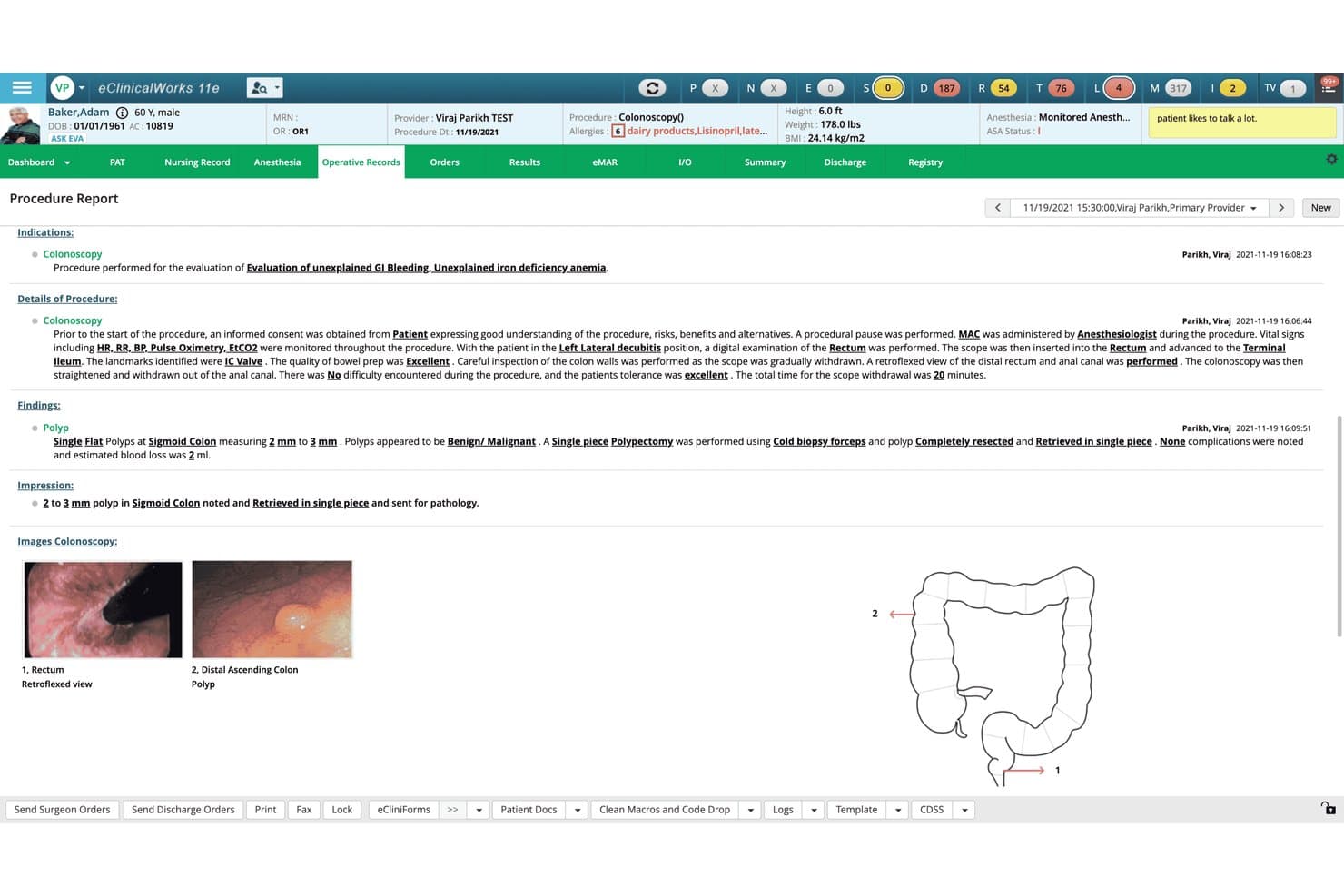 eClinicalWorks-Bericht über eine Koloskopie mit Polypenbefunden, Bildern und einem Dickdarmdiagramm.