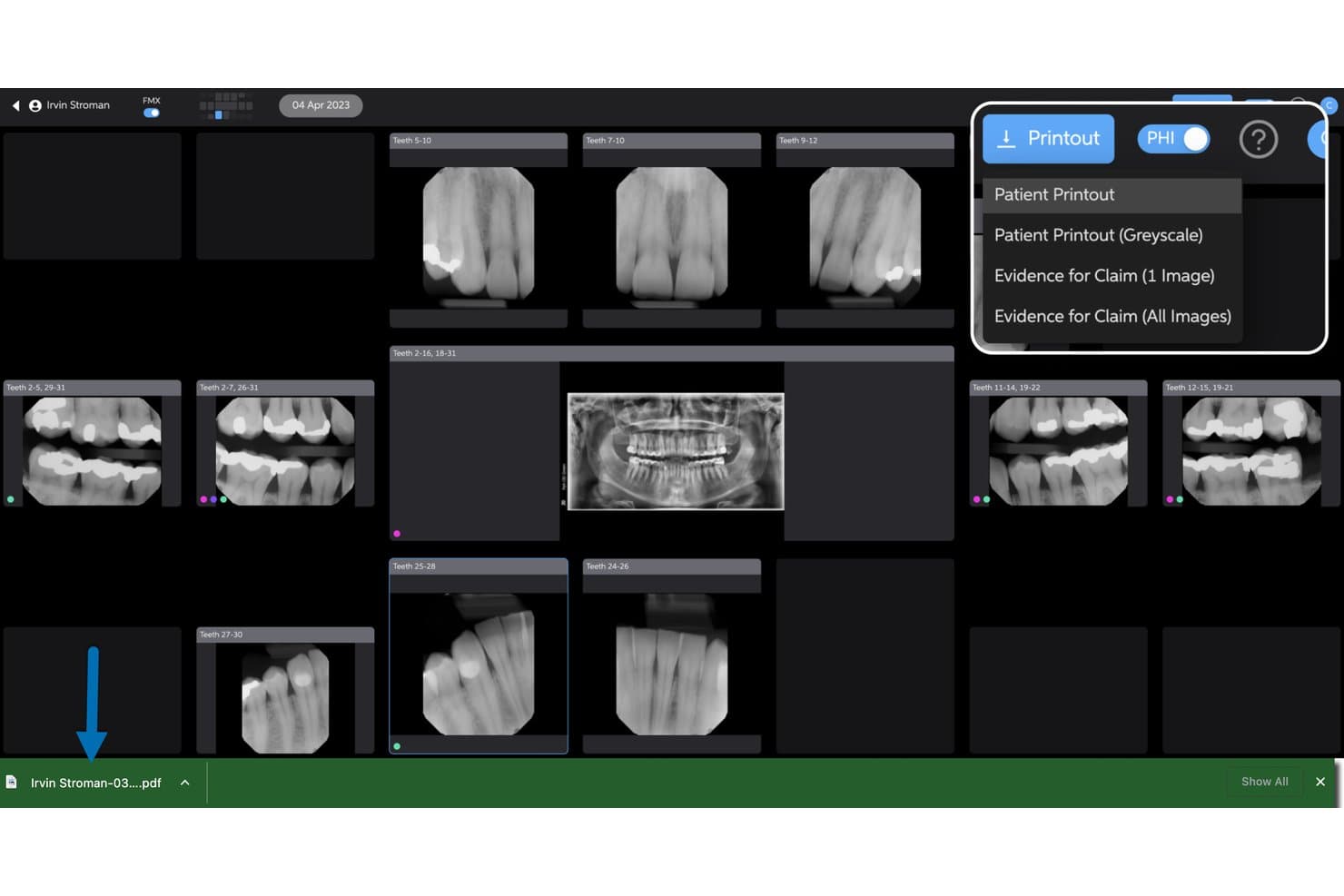 Pearl dental software showing X-ray images with printout dropdown menu options visible.