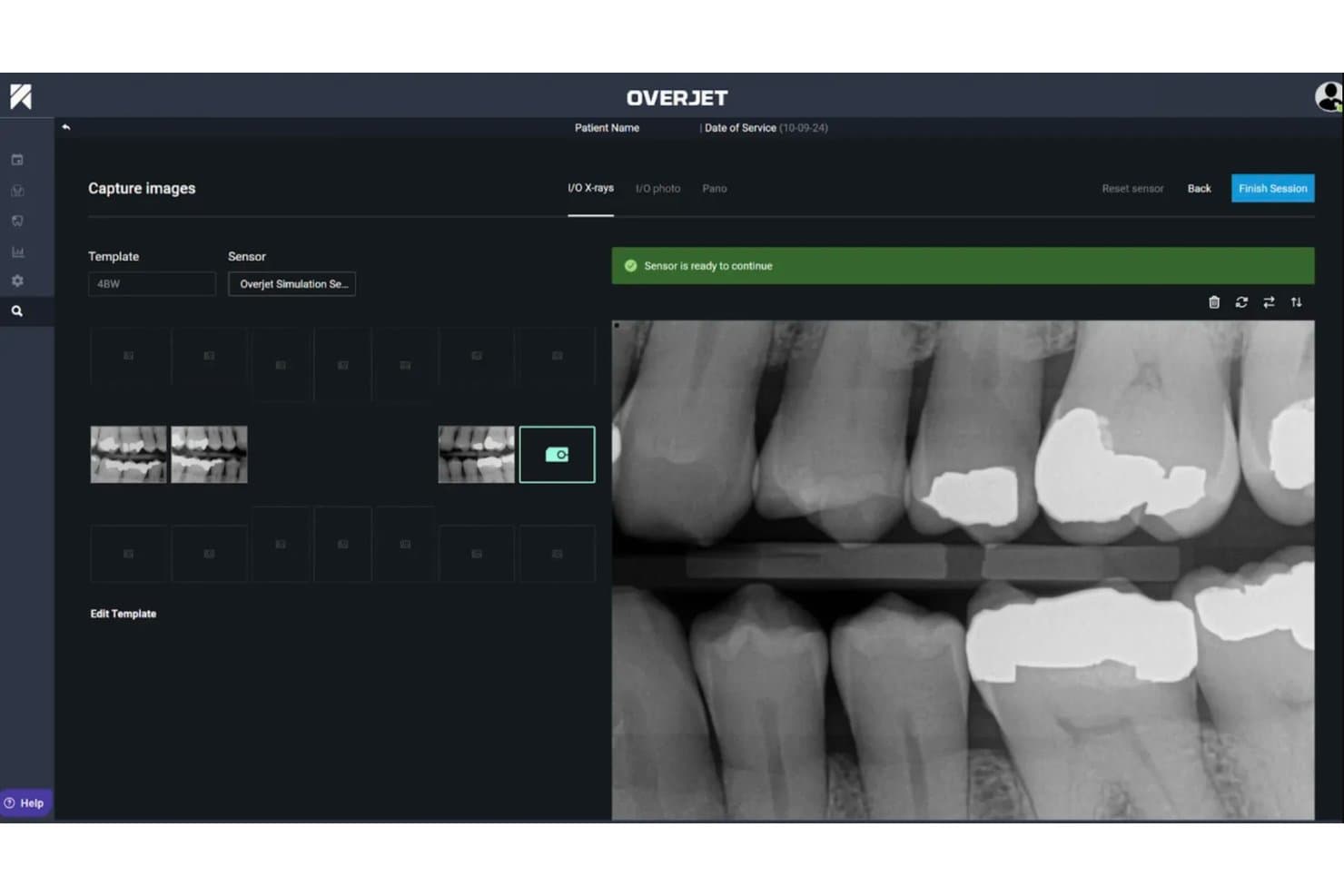 Overjet dental software showing X-ray capture screen with bitewing radiographs and sensor ready status.