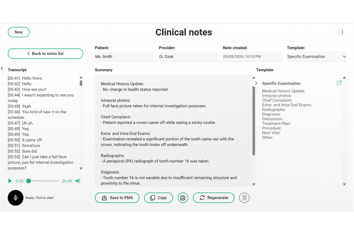 Denti.AI clinical notes screen showing transcript, AI-generated summary, and examination template.