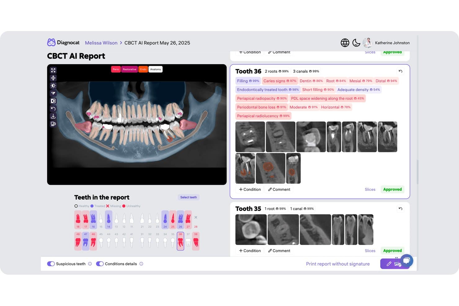 Diagnocat CBCT AI report showing tooth 36 findings with annotated scan slices and condition tags.