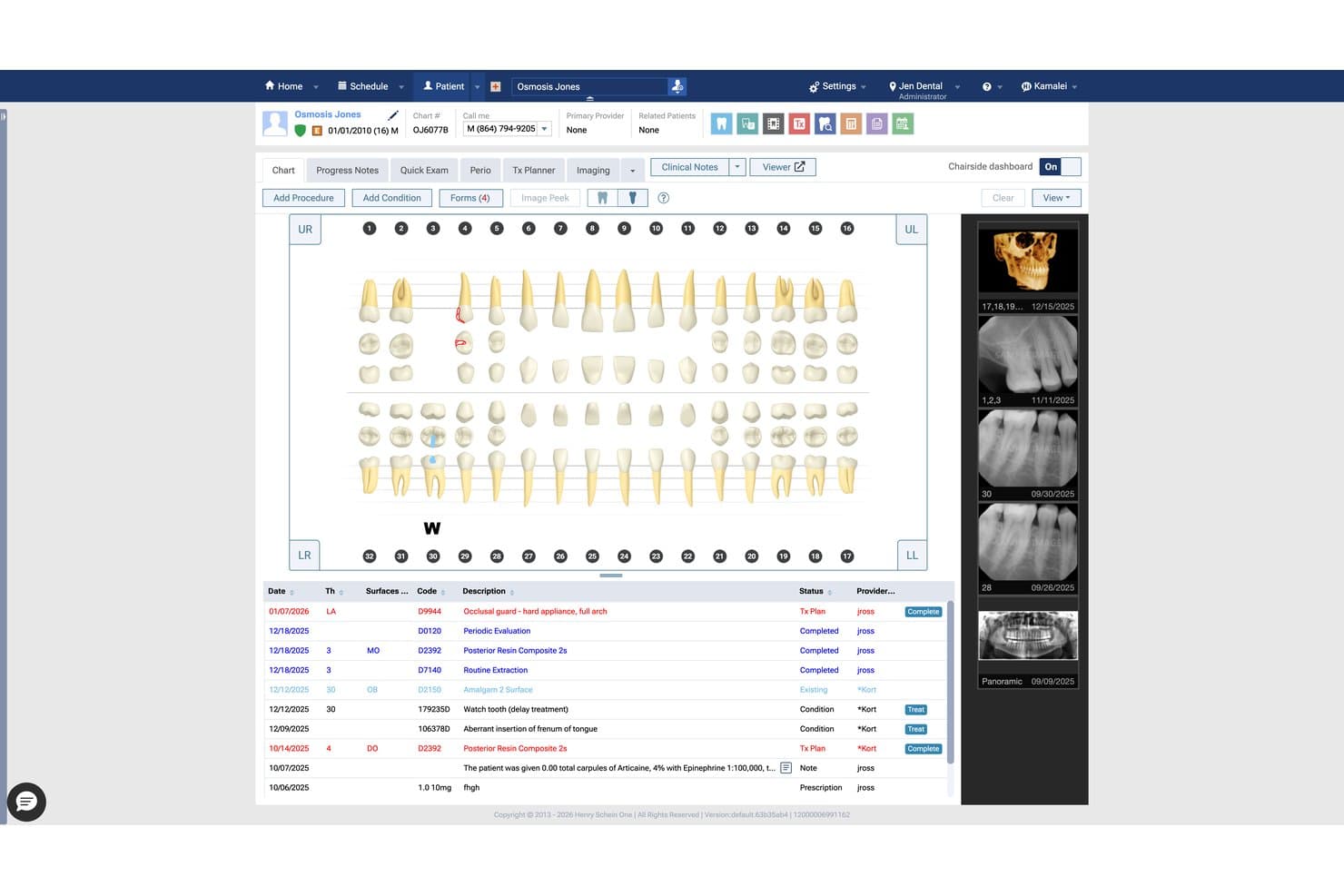 Dentrix Ascend patient chart showing dental diagram, procedure list, and X-ray thumbnails.