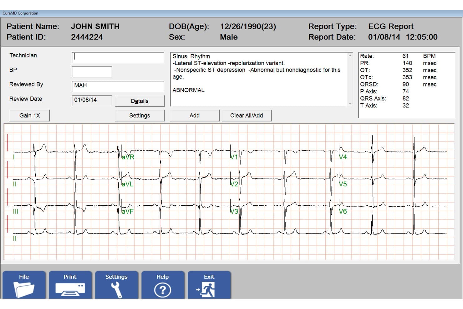 ECG-rapportscherm van CureMD met 12-afleidingen-EKG-golfvormen en diagnostische patiëntgegevens.