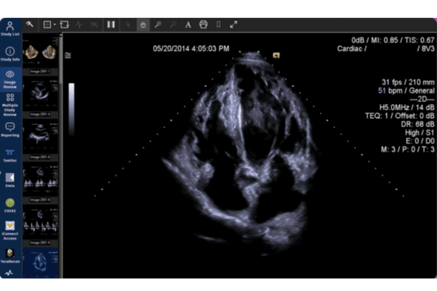 Scherm voor beoordeling van echocardiografiebeelden in Merative Merge Cardio