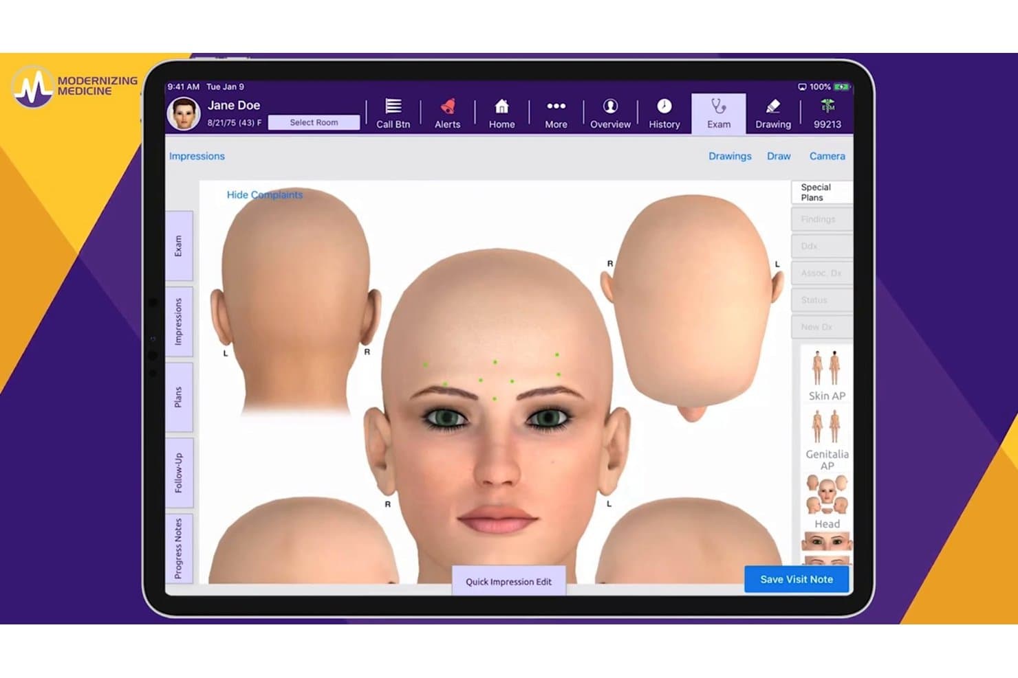 Schermata d'esame EHR di ModMed che mostra un modello 3D della testa con disturbi alla fronte contrassegnati per la paziente Jane Doe.