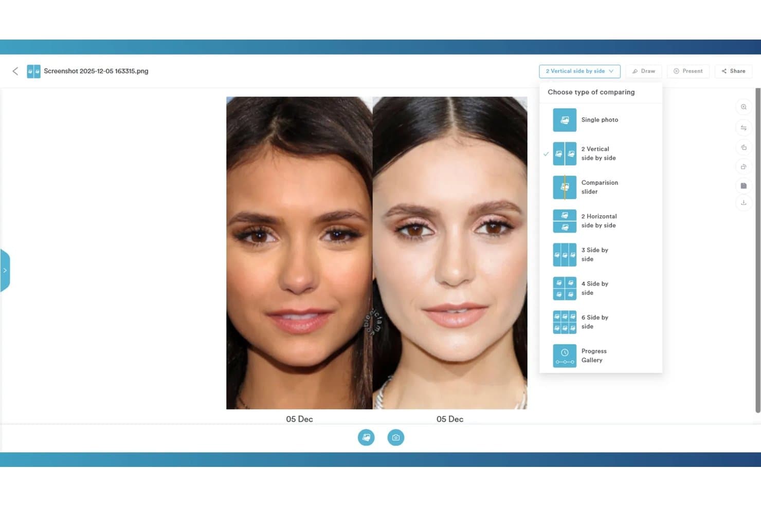 Pabau before-and-after photo comparison interface showing two female face photos side by side with layout options menu open.