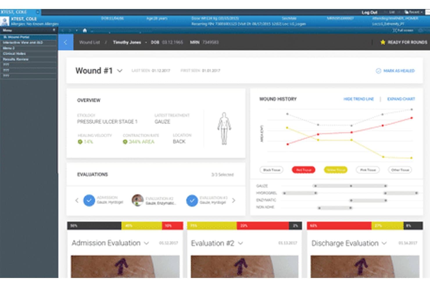 EPD-dashboard voor wondzorg van Tissue Analytics met een grafiek van de wondgeschiedenis, weefseltypen en patiëntevaluaties.