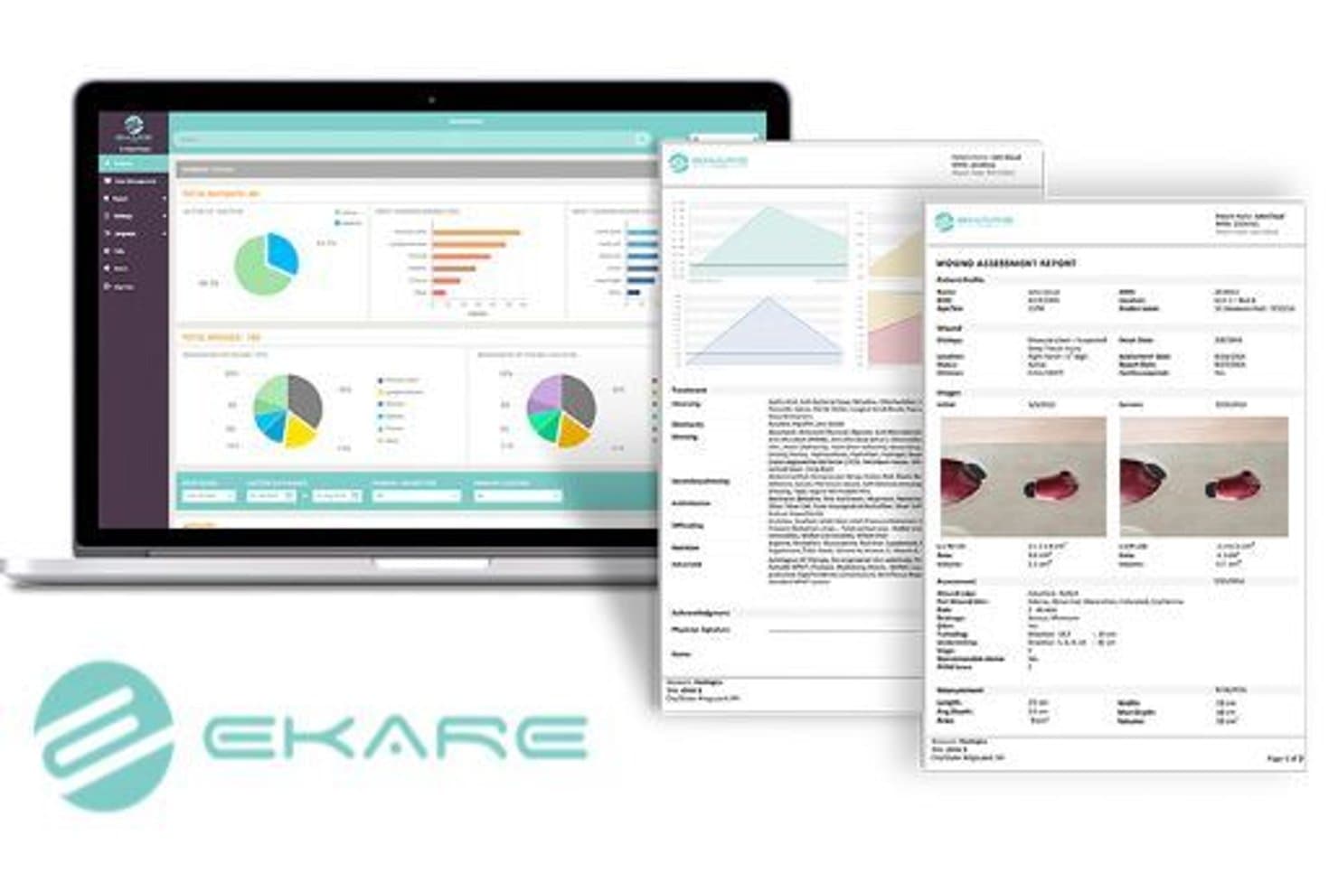 Ekare