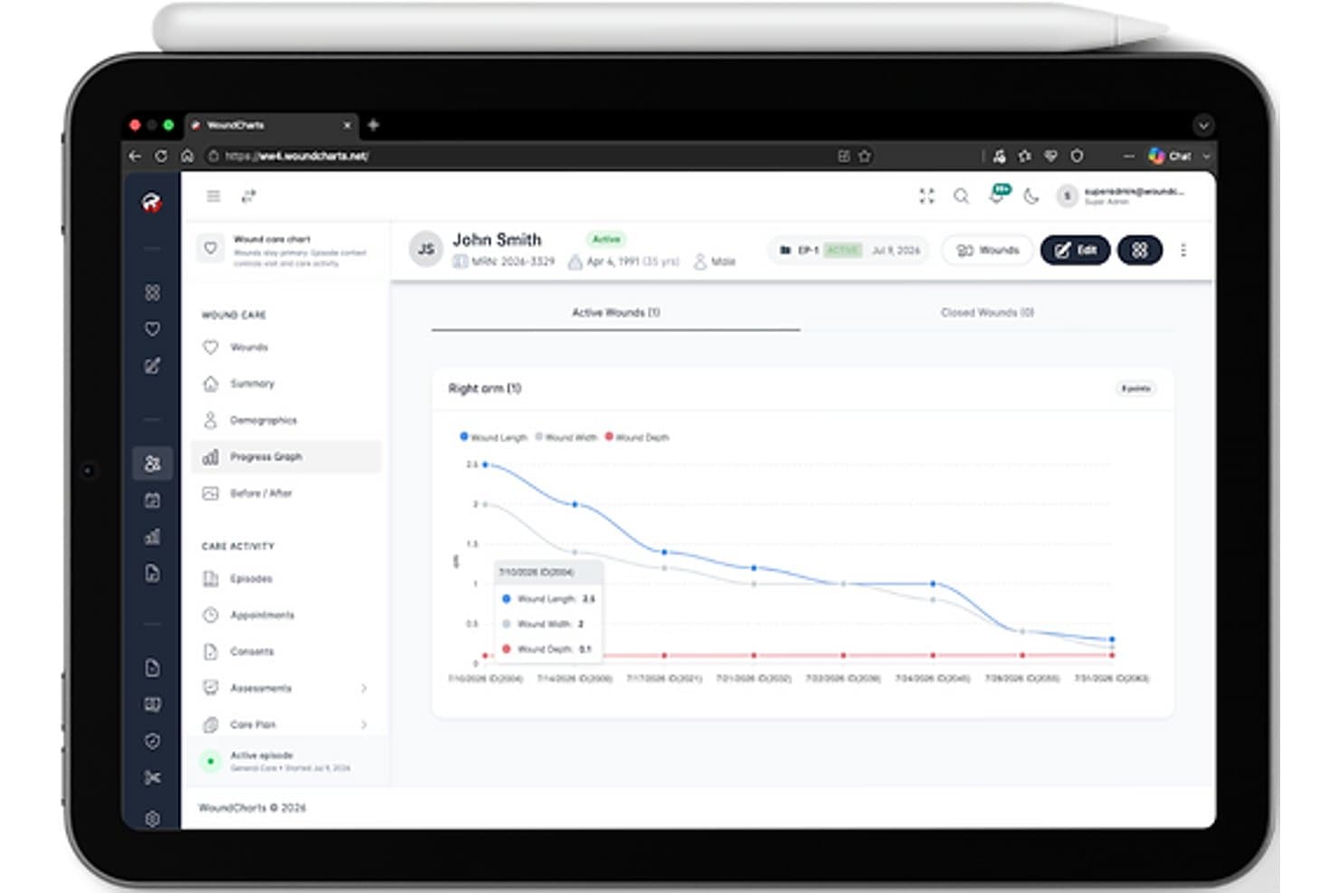 Interfaccia tablet di Wound Charts che mostra un grafico dei progressi della ferita con linee di andamento relative a lunghezza, larghezza e profondità.