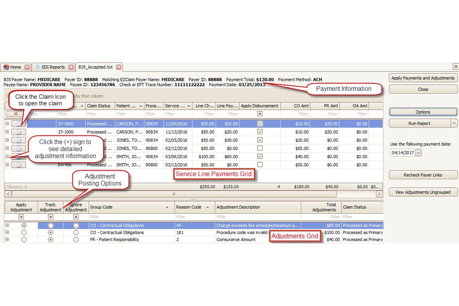 EZClaim EDI 835 payment posting screen showing service line payments and adjustments grid.