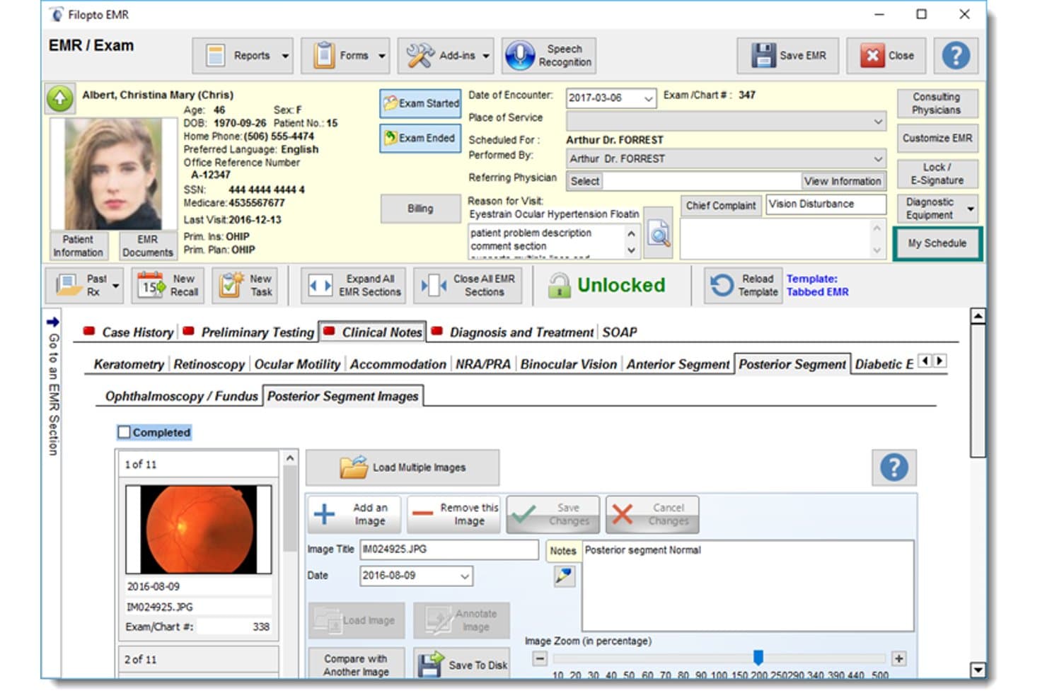 Filopto-EMR-Bildschirm mit einem Netzhautbild des hinteren Augenabschnitts und Patientendetails.