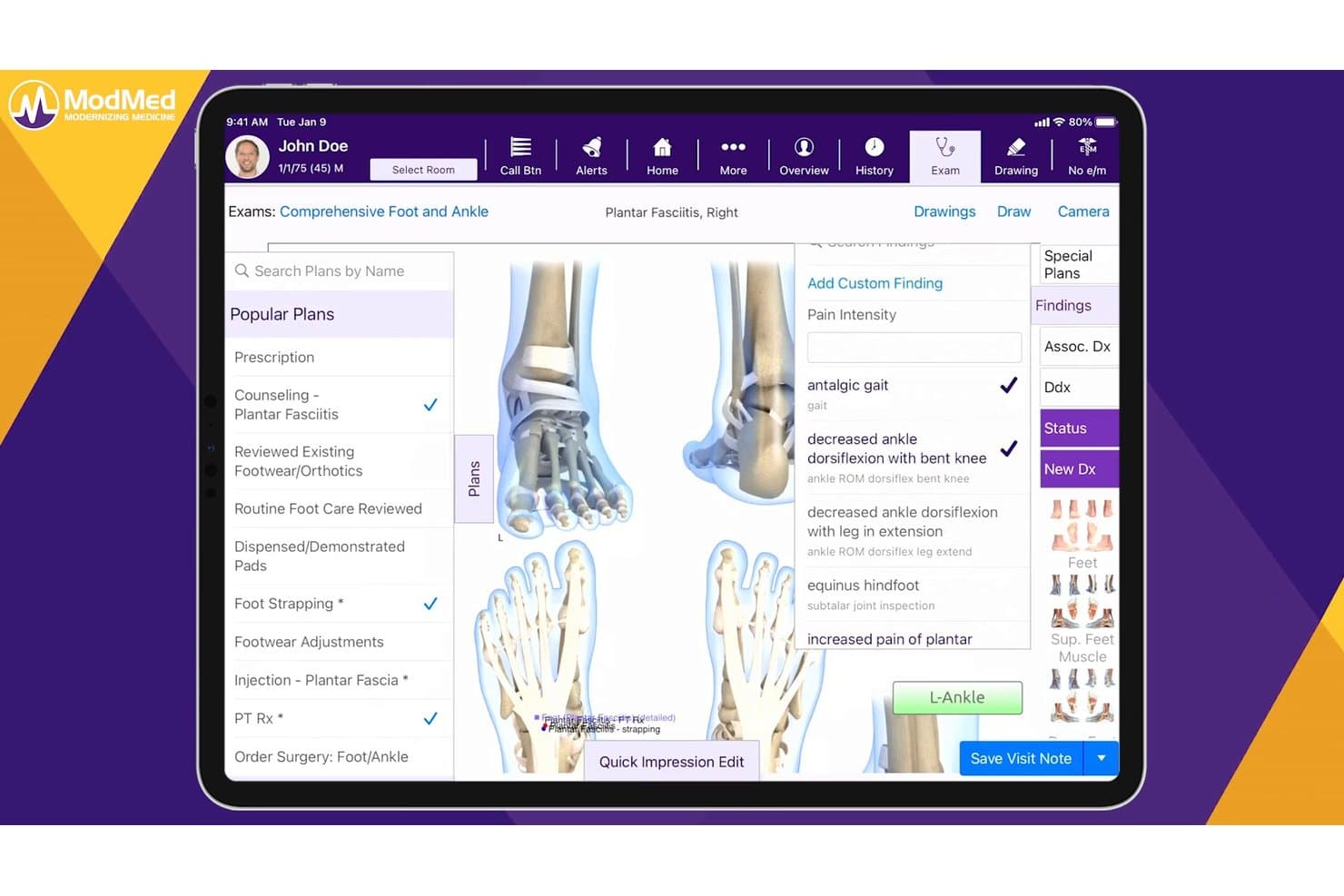 ModMed podiatry EHR screen showing plantar fasciitis exam with treatment plans and findings panel.