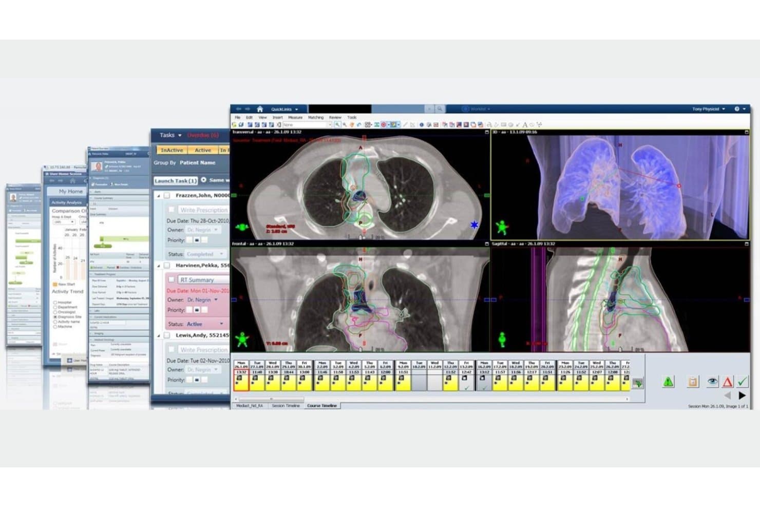 Varian ARIA-Bildschirm mit mehreren Fenstern, der CT-Aufnahmen der Lunge mit Bestrahlungskonturen und einer Patientenaufgabenliste zeigt.