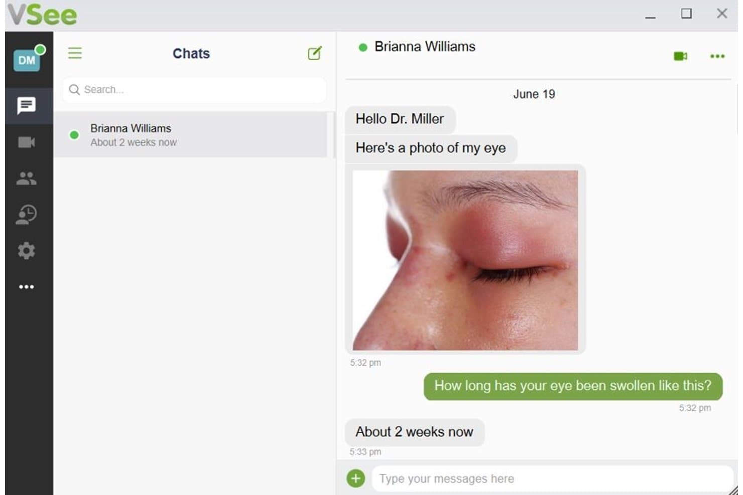 VSee-Telemedizin-Chat, in dem ein Patient dem Arzt ein Foto eines geschwollenen Auges sendet