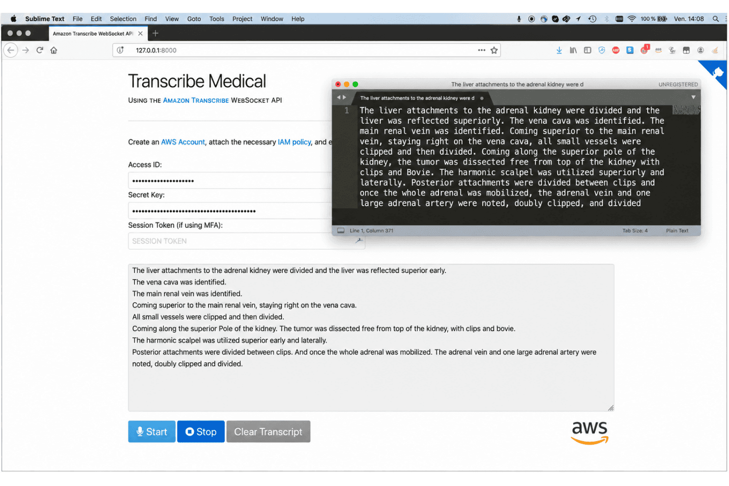 Amazon Transcribe Medical zet klinische spraak in realtime om naar medische tekst.
