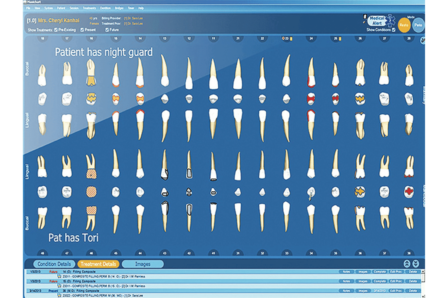MaxiDent's dental charting interface