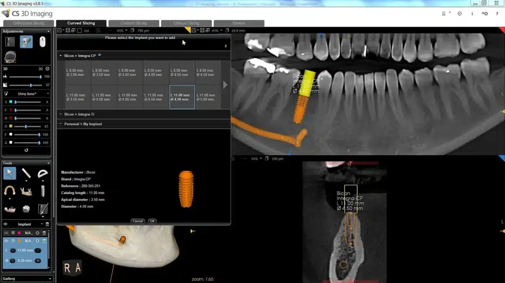 Carestream Dental screenshot - Les 14 Meilleurs Logiciels Dentaires Passés en Revue en 2026