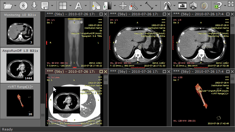 RadiAnt screenshot - 10 Meilleurs Logiciels DICOM Testés pour 2026