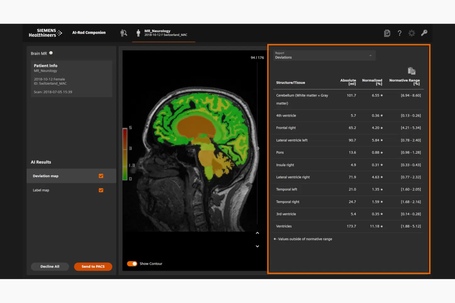 Siemens Healthineers screenshot - 10 Beste KI-Lösungen im Gesundheitswesen im Jahr 2026 bewertet