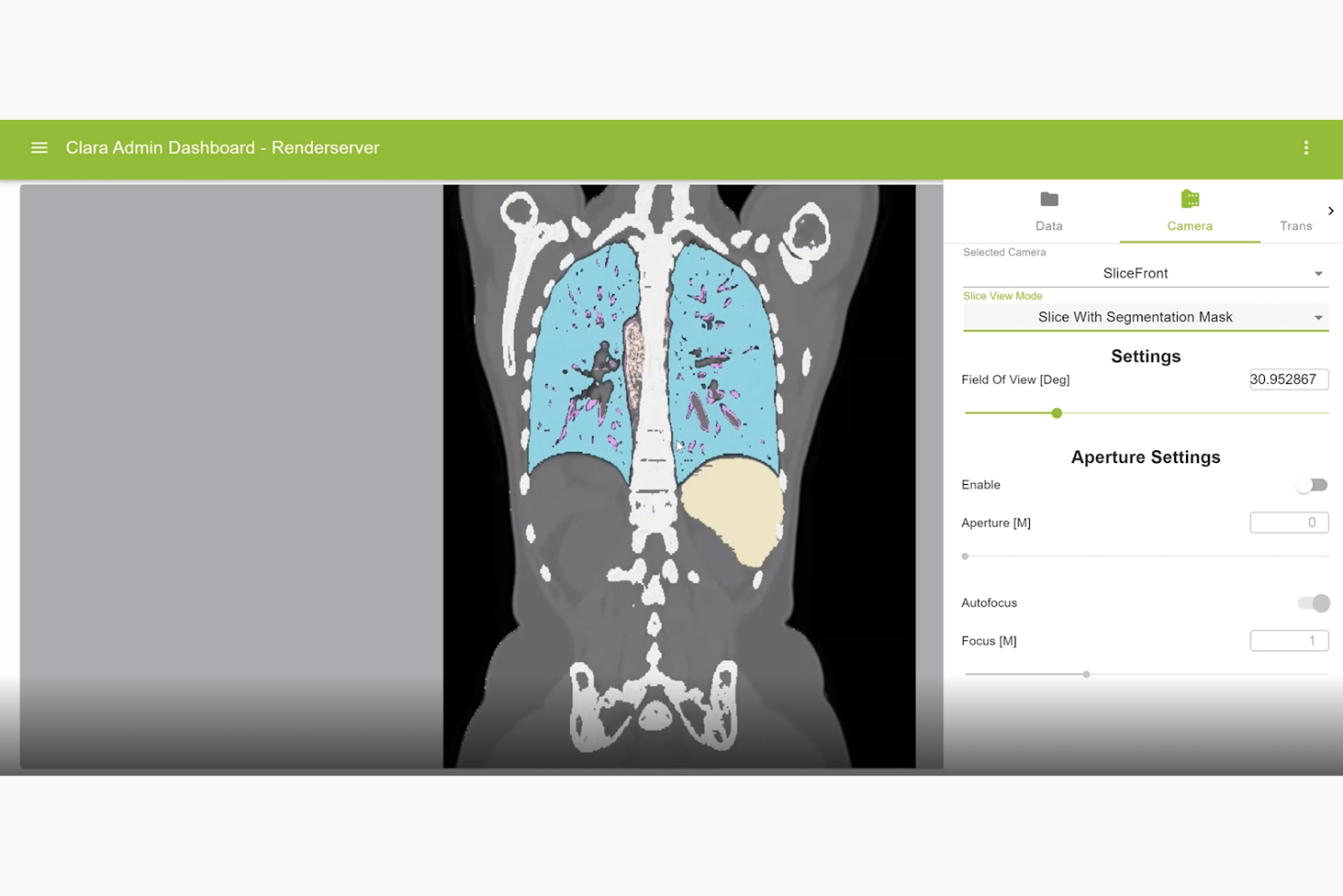 NVIDIA AI screenshot - 10 Meilleures Solutions d’IA en Santé Passées en Revue en 2026
