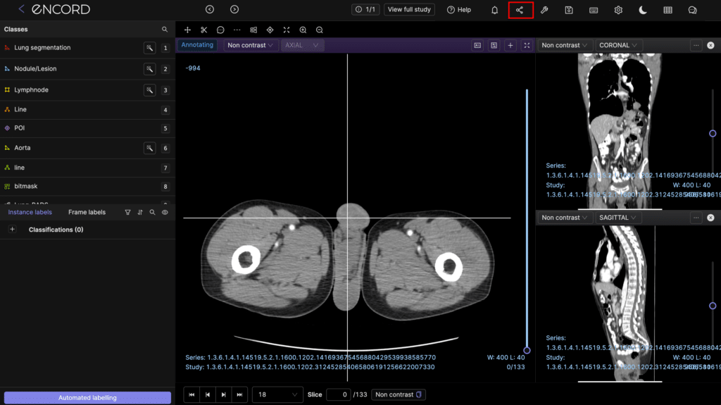 Encord screenshot - 10 meilleurs logiciels DICOM évalués pour 2026