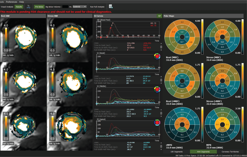 Siemens Healthineers screenshot - 10 Meilleurs Logiciels de Cardiologie Passés en Revue en 2026