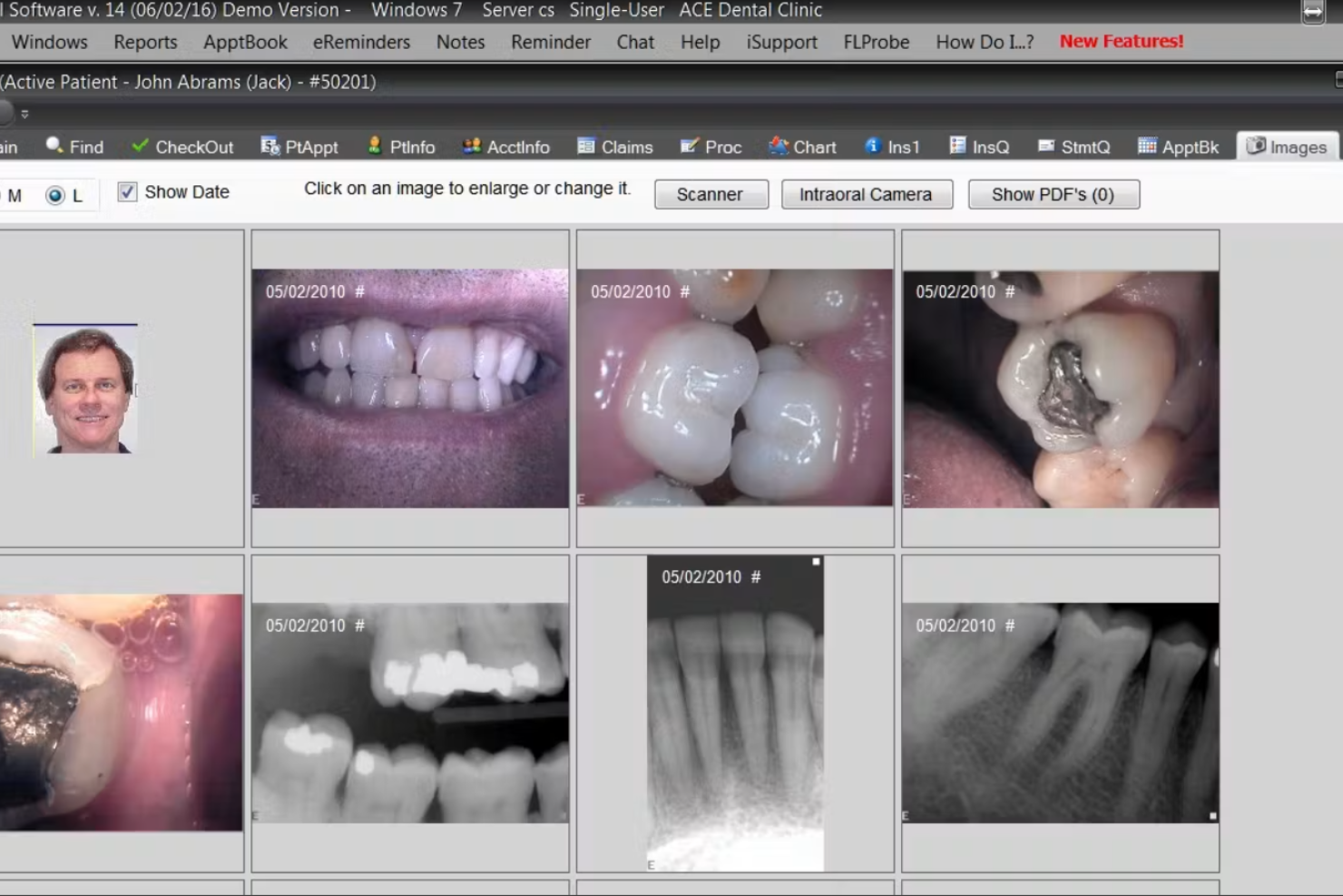 Dentrix screenshot - I 10 migliori software dentali recensiti nel 2026