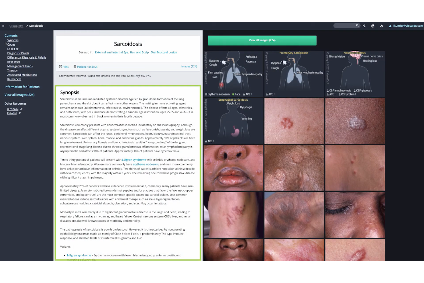 VisualDx screenshot - 10 migliori sistemi di supporto decisionale clinico recensiti nel 2026