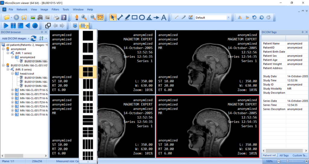 MicroDicom screenshot - 10 Mejores Programas DICOM Analizados para 2026