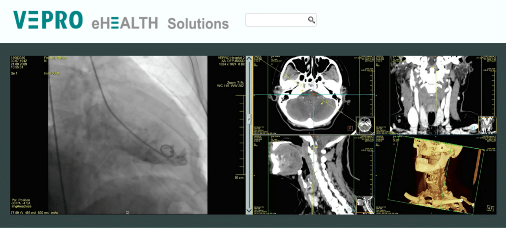 VEPRO screenshot - 10 Migliori Software DICOM Recensiti per il 2026
