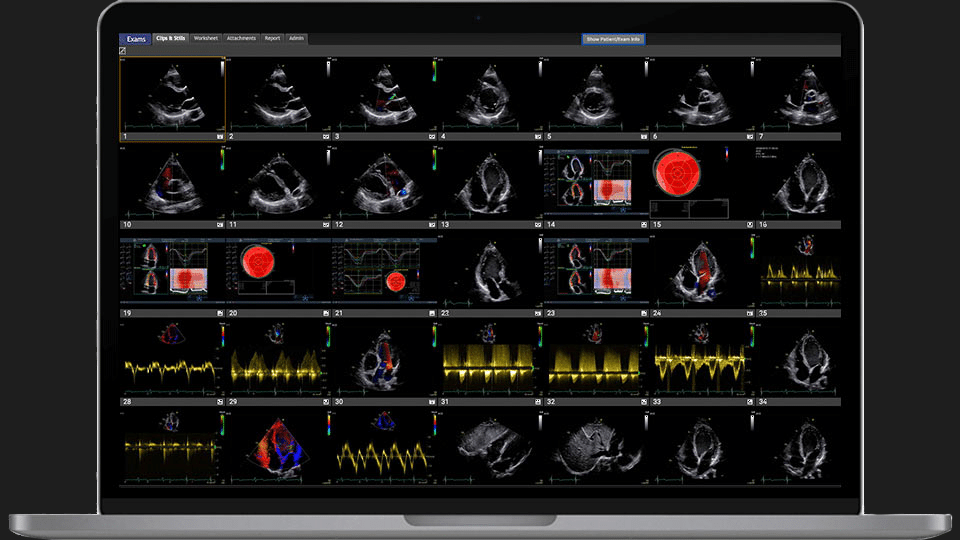 UltraLinq screenshot - 10 Migliori Software DICOM Recensiti per il 2026
