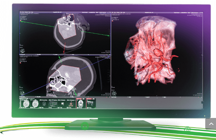 Visage 7 screenshot - 10 Mejores Software de Imágenes Médicas de 2026