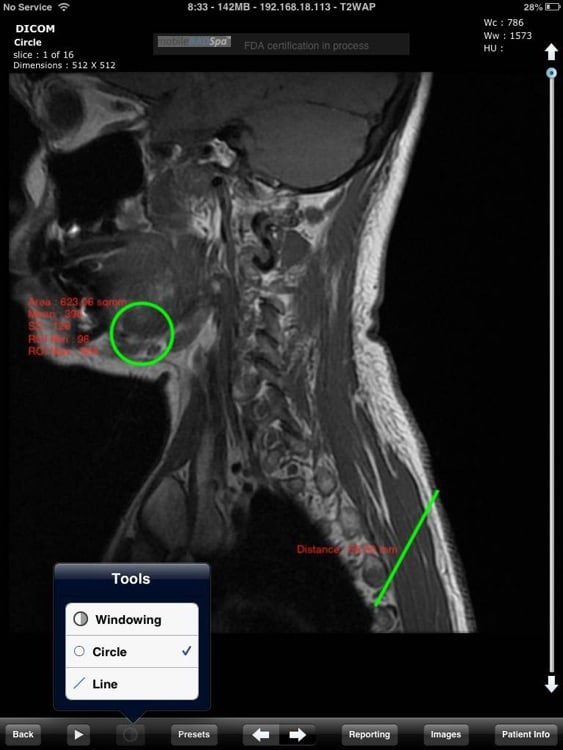 RADSpa screenshot - 10 Migliori Software di Imaging Medico del 2026