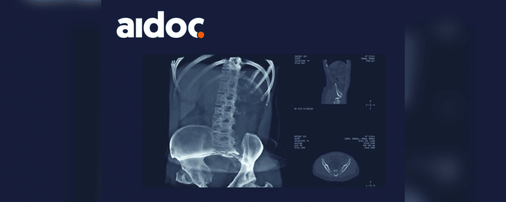 Aidoc screenshot - 10 Mejores Software de Imágenes Médicas de 2026