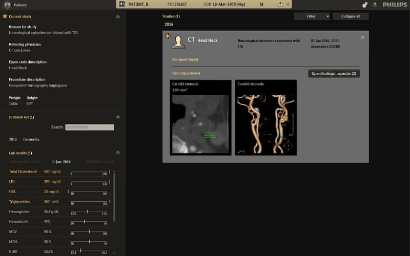 Philips Radiology Informatics screenshot - 10 mejores programas PACS revisados para 2026