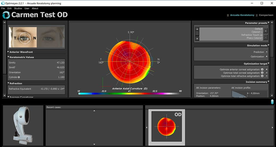 Ansys screenshot - 10 mejores programas de simulación médica analizados para 2026