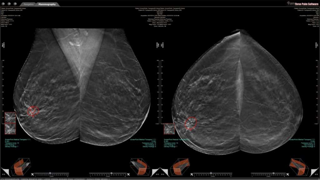 Three Palm Software screenshot - 10 migliori sistemi informativi di radiologia recensiti nel 2026