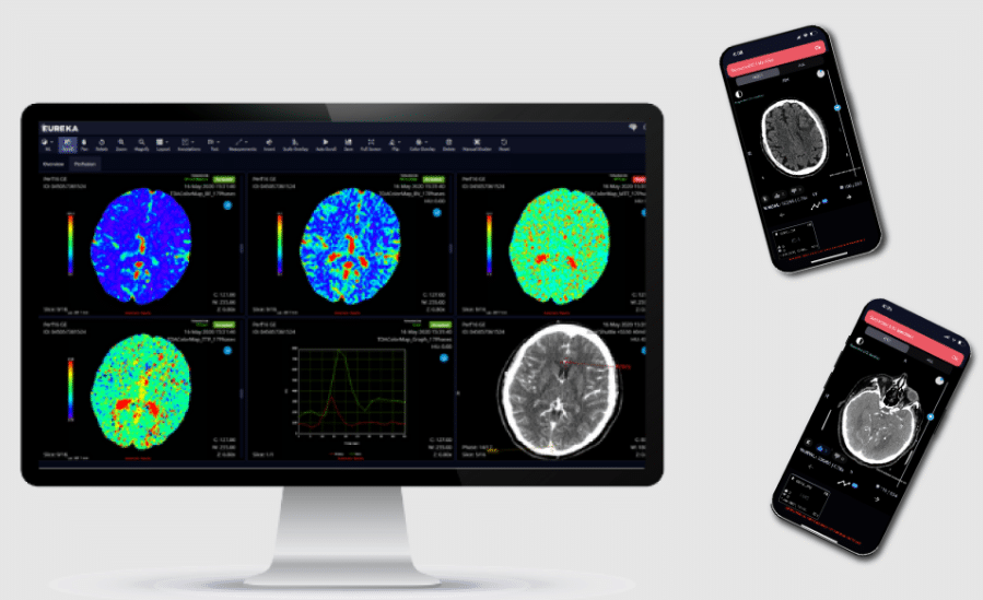 TeraRecon screenshot - 10 migliori soluzioni software di radiologia recensite per 2026