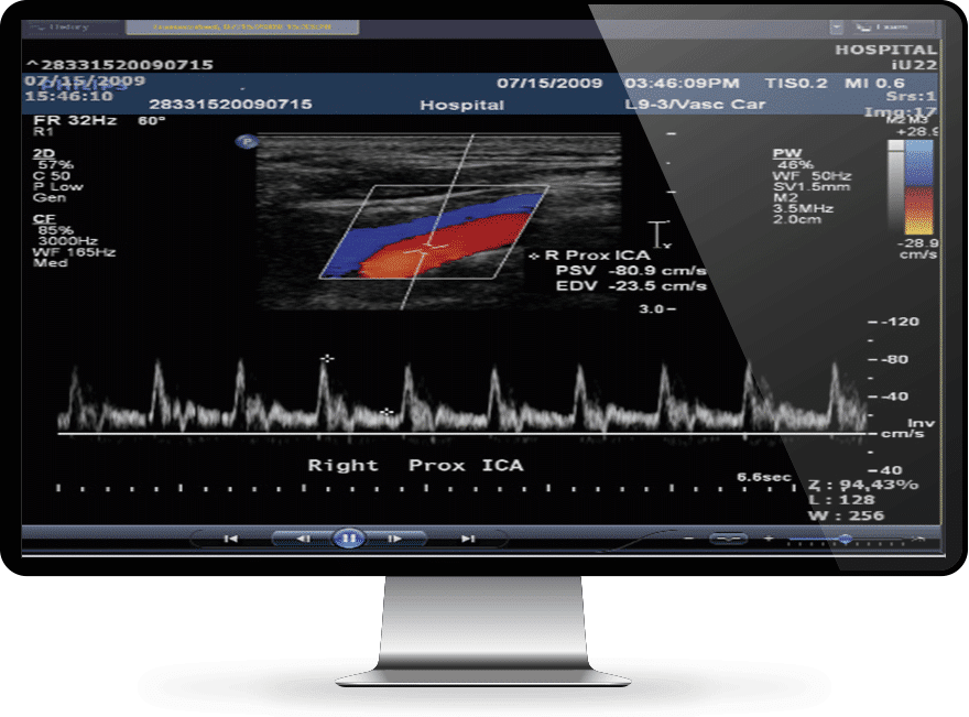INFINITT Cardiology Suite screenshot - 10 migliori software di cardiologia recensiti nel 2026