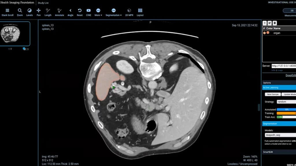 NVIDIA screenshot - 10 Mejores Software de Imágenes Médicas de 2026