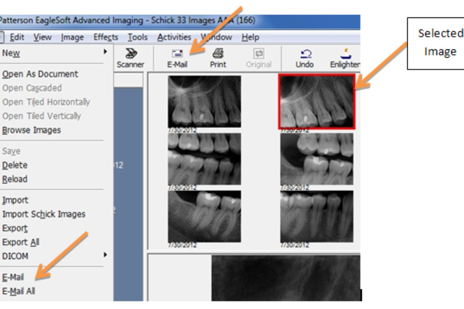 Eaglesoft screenshot - The 10 Best Dental Software Reviewed in 2026