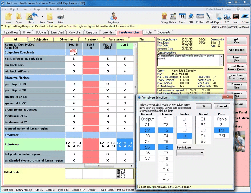 EZBis review screenshot showing selection of vertibrae